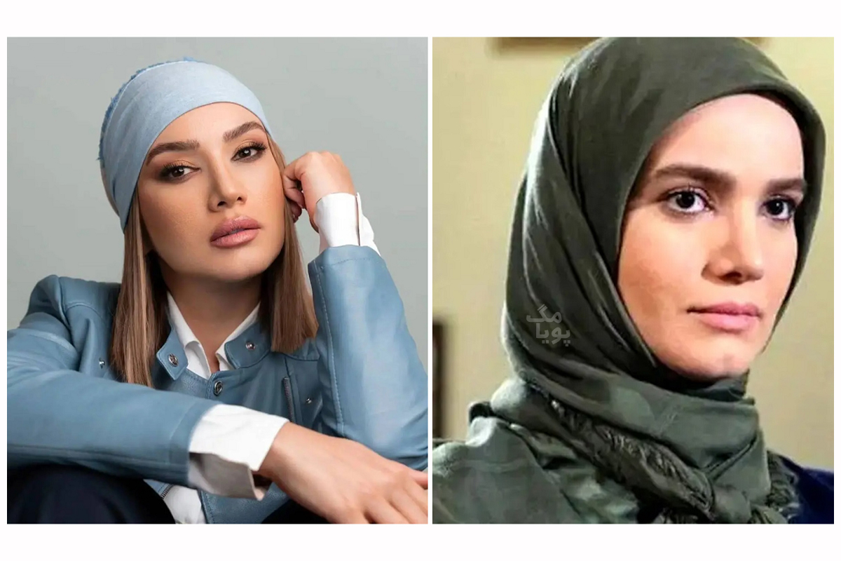 جراحی های صورت متین ستوده